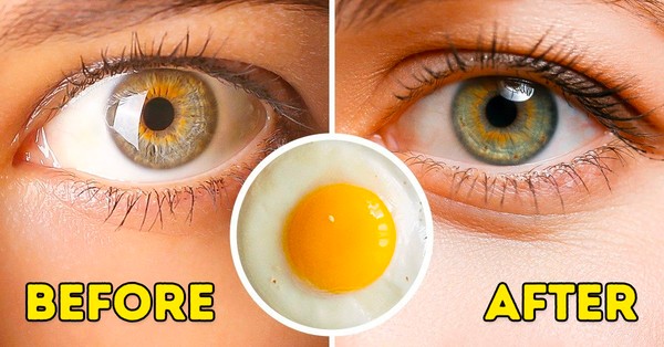 grow-eyelashes