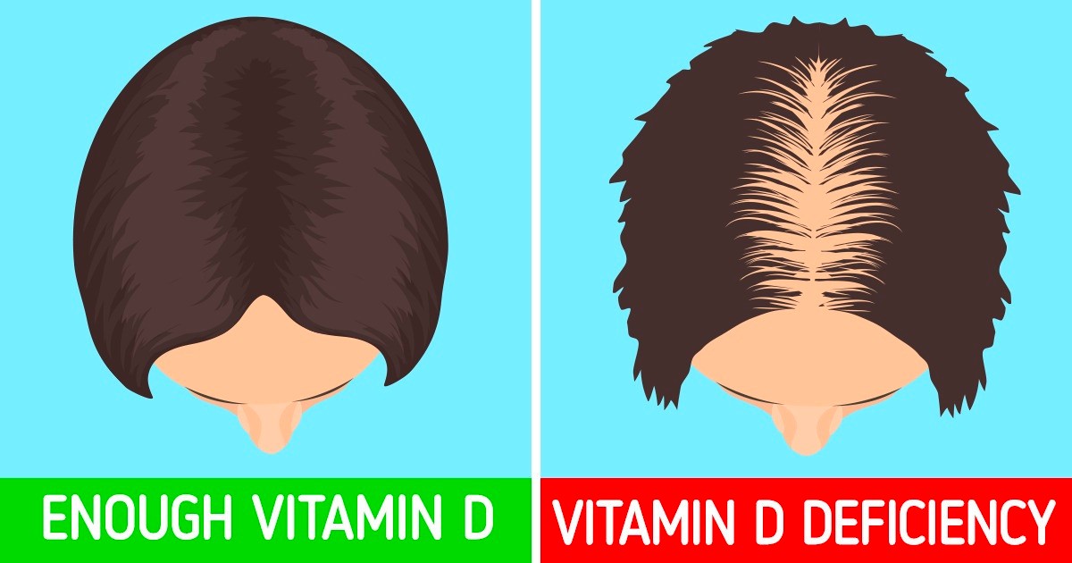 vitamin-d-deficiency