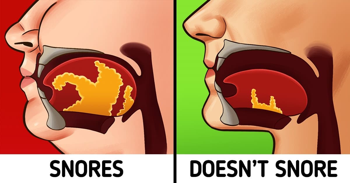 ways-to-stop-snoring